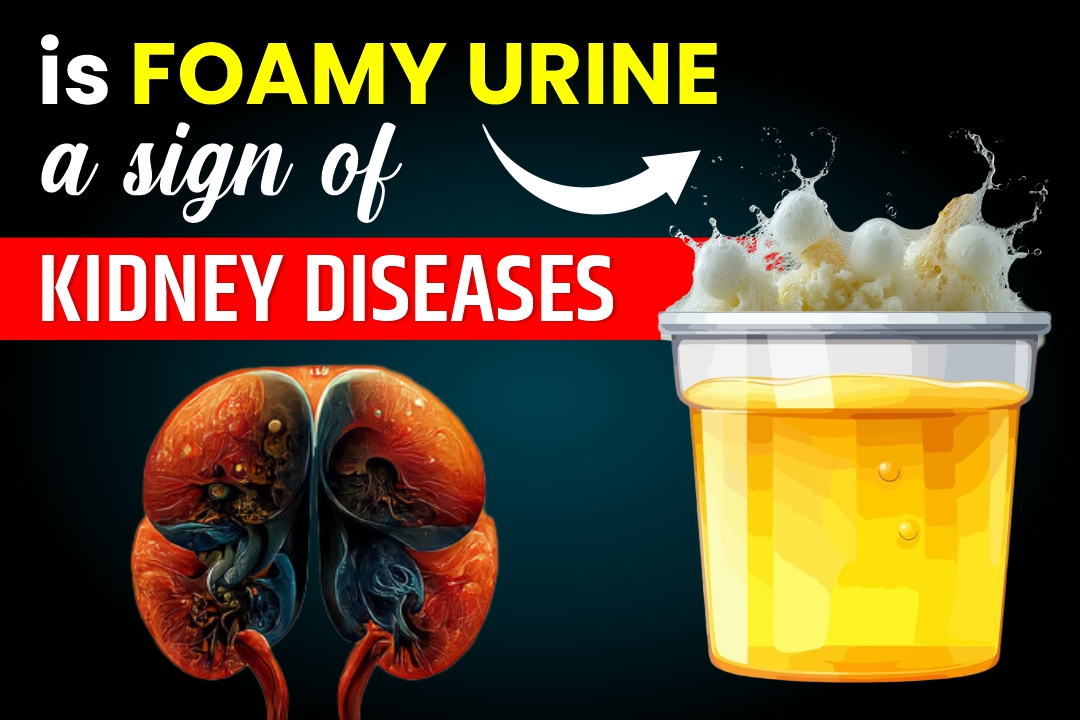 Is Foamy Urine a Sign of Kidney Damage? Natural Ayurvedic Insights